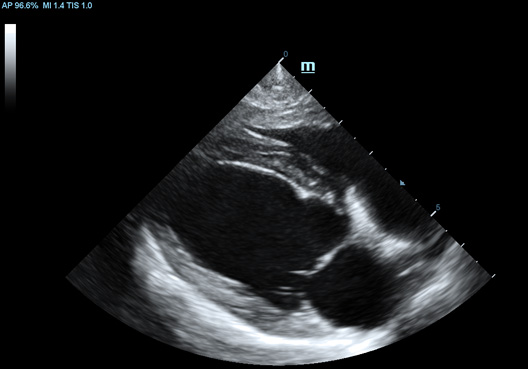 Long Axis View of Canine Heart